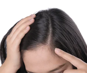 HAIRestart® - Stimularea non-invazivă a creșterii părului